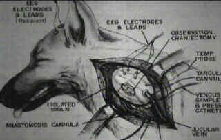 Transplanted Brain